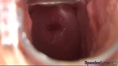 Jouer Le jeu médical pervers d'une blonde avec un spéculum et un gode baise sa chatte humide